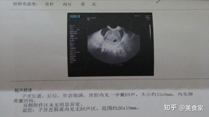 成都人流医院网